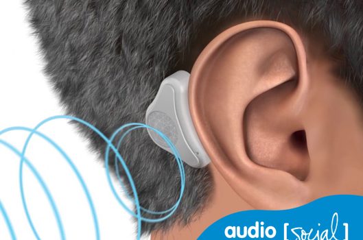 audiopacks adhear medel